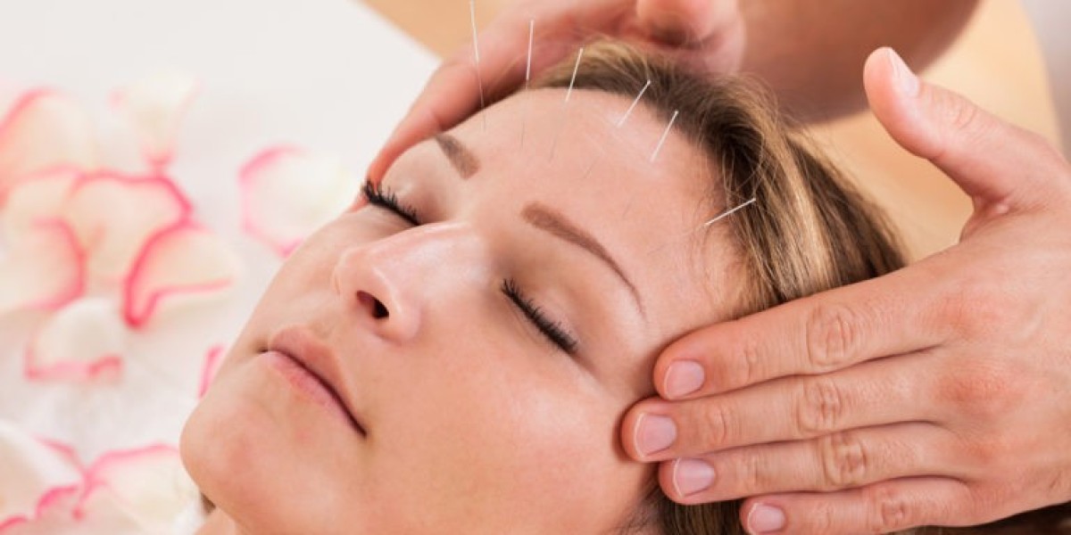 Moxa Treatment Service: A Natural Approach to Stress Relief
