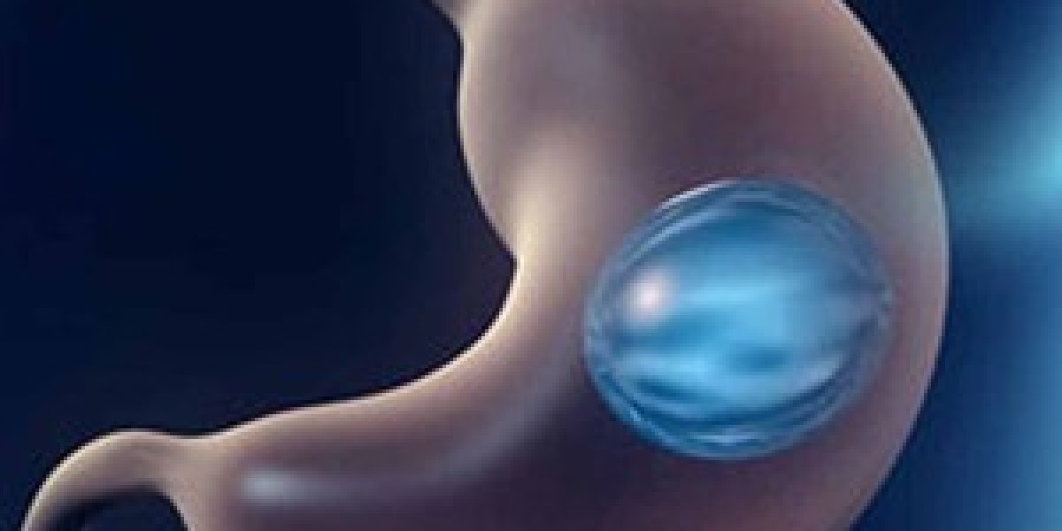 Non-Invasive Weight Loss: Gastric Balloon in Riyadh