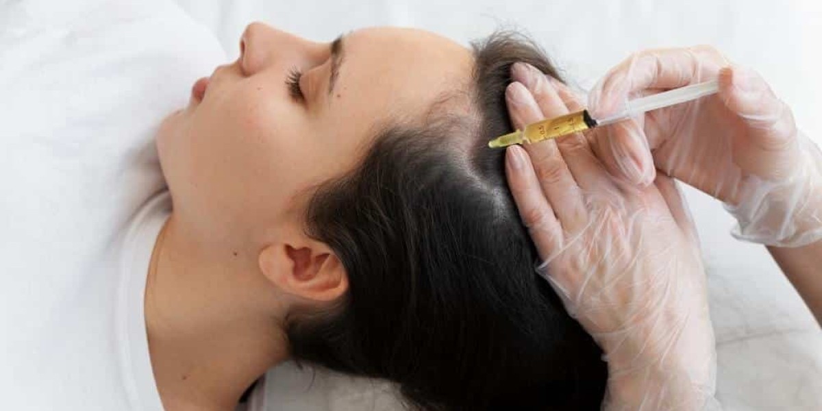 "Long-Term Effects of PRP Hair Treatment"
