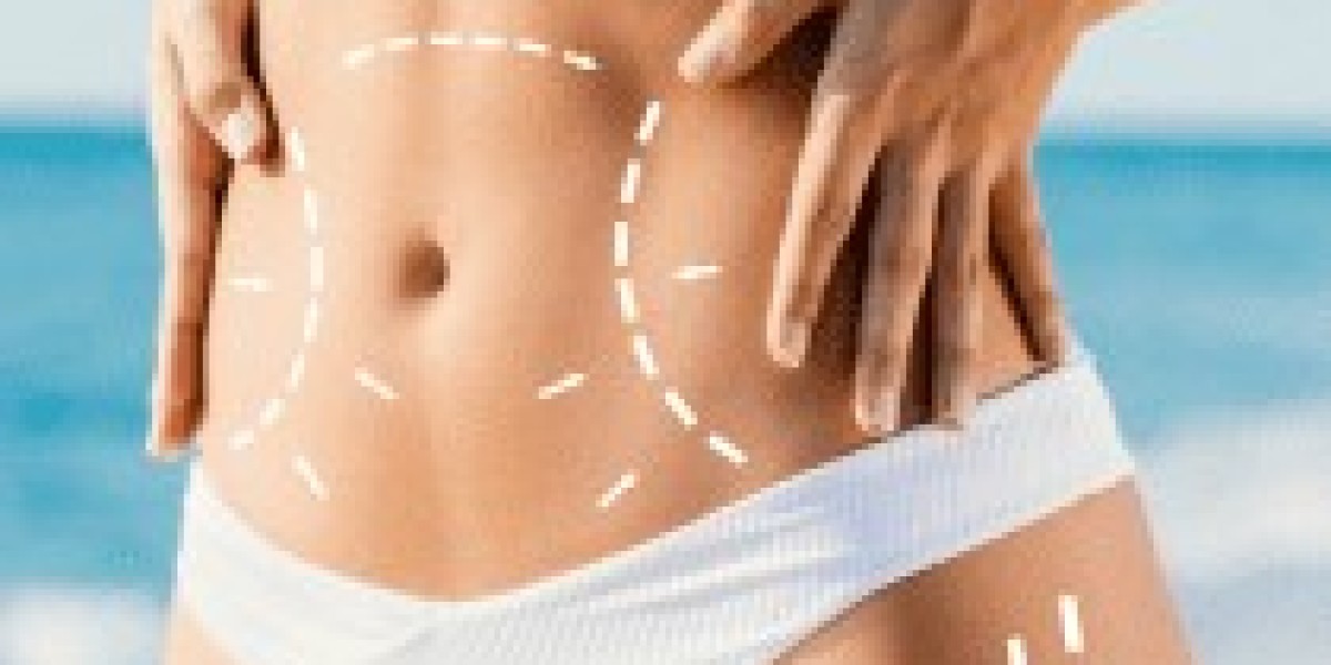 Affordable CoolSculpting: Cost-Saving Tips for Dubai Residents