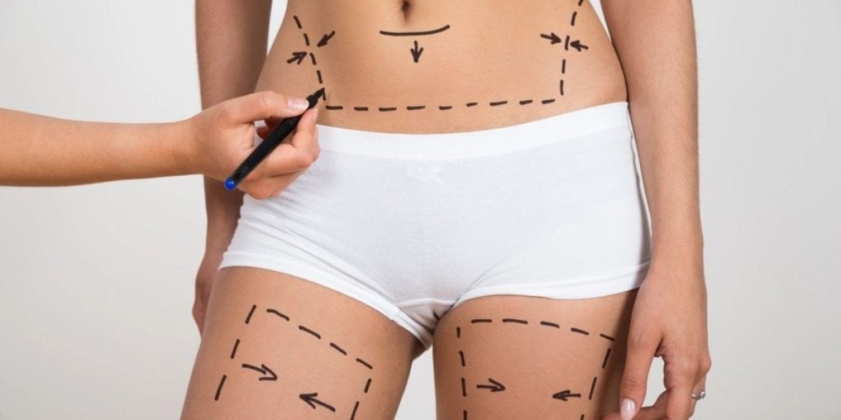 Exploring the World of Lower Body Lift Surgery in Dubai