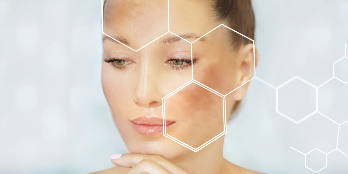 Post-Treatment Care for Melasma