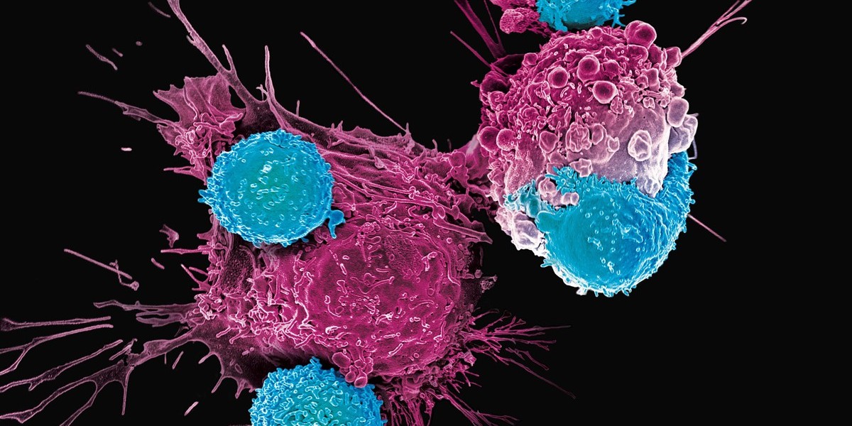 CAR T-Cell Therapy Market Report (2024-2034): Epidemiology, Industry Trends, Share, Size, Demand