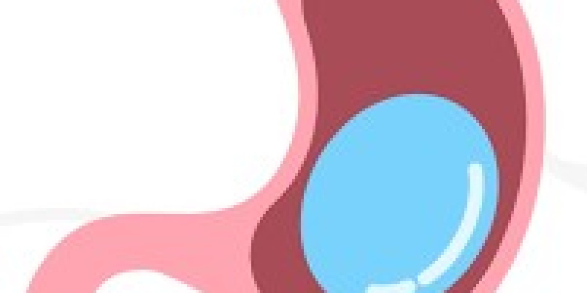 Achieve Your Dream Body with Gastric Balloon Surgery