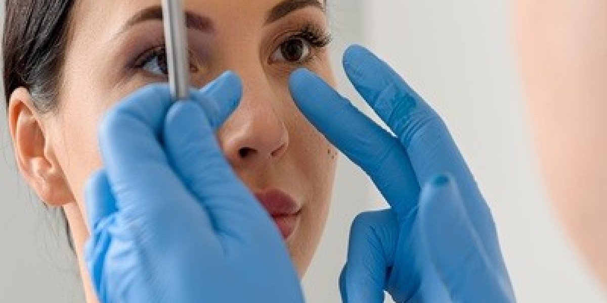 Rhinoplasty Surgery in Dubai: Transforming Noses with Precision and Expertise