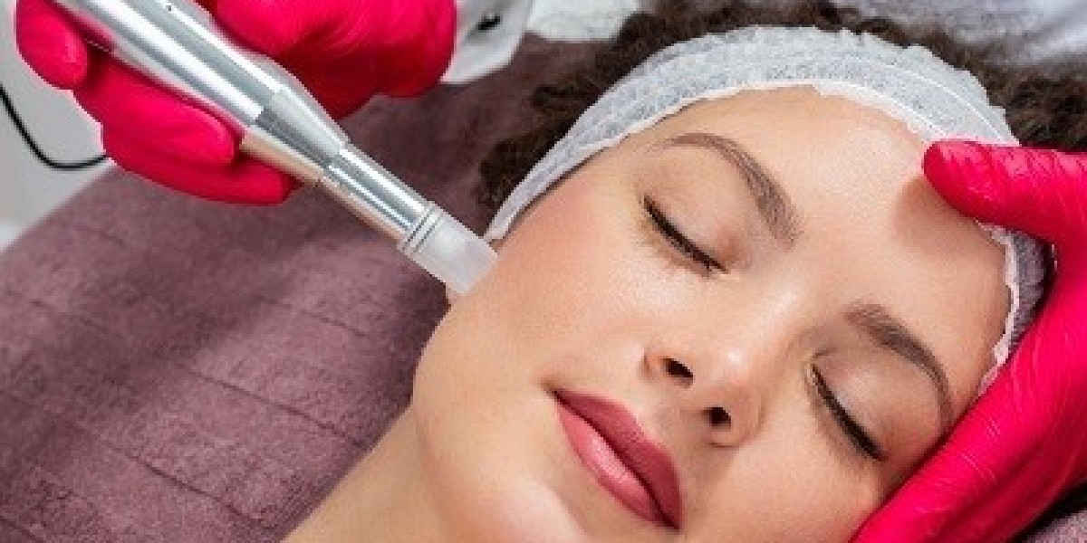 What to Expect After Microneedling Treatment
