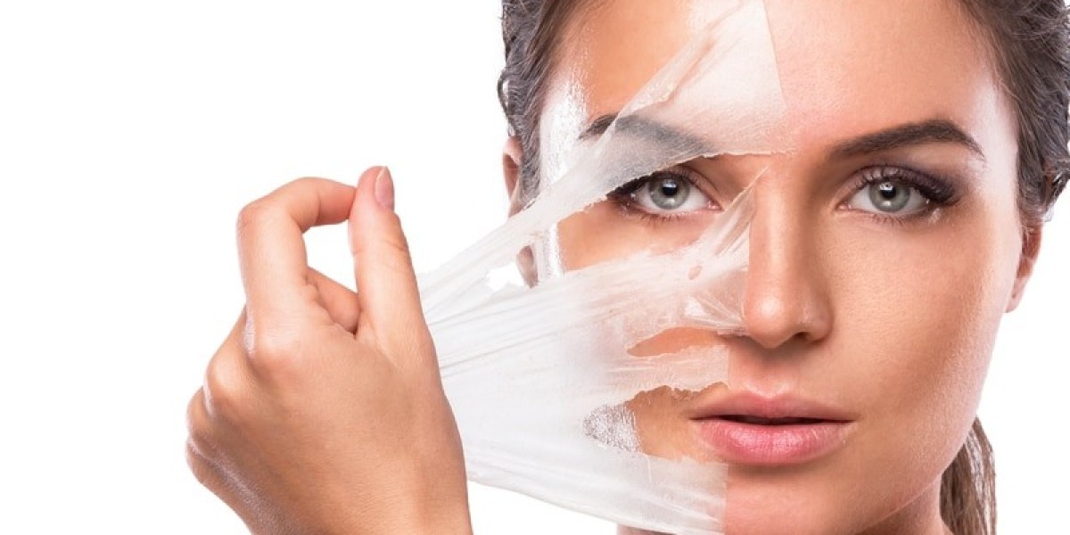 Transform Your Skin: The Ultimate Guide to Cosmelan Peel Treatment in Dubai