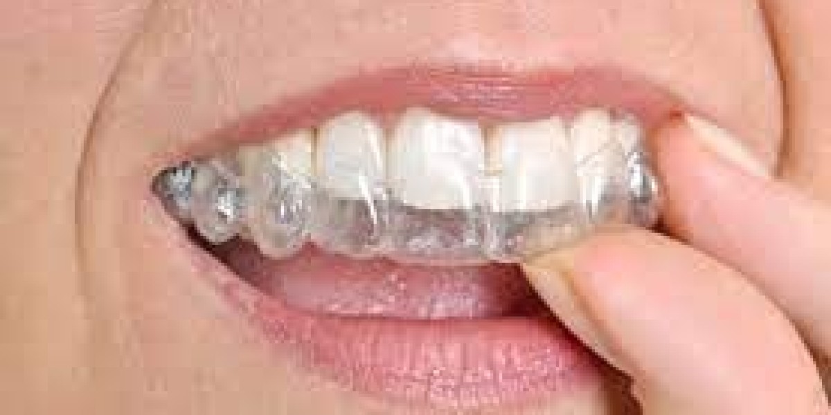 Tips for Saving on Invisalign Costs in Dubai