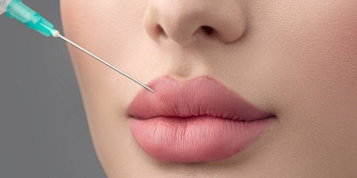 Common Myths About Russian Lip Fillers in Dubai