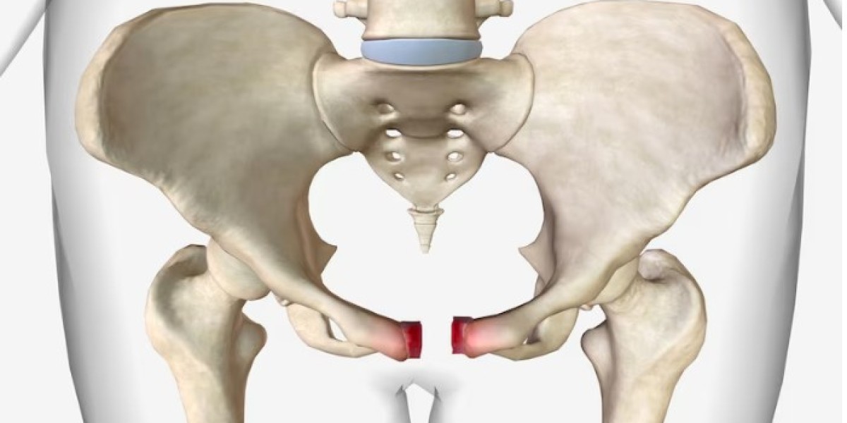The Ultimate Guide to Hip Replacement Cost in India