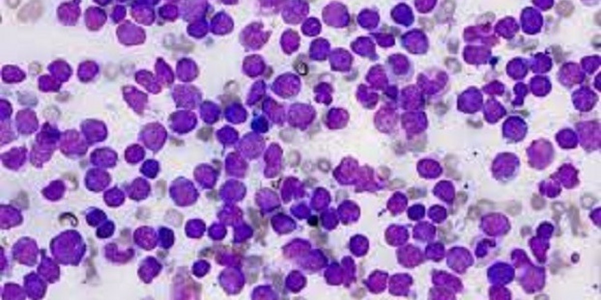 Acute Lymphoblastic Leukemia Market Size, Trends And Forecast To 2034