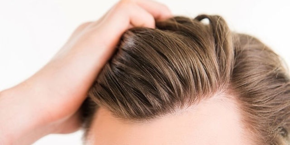 The Recovery Process After an FUE Hair Transplant in Dubai