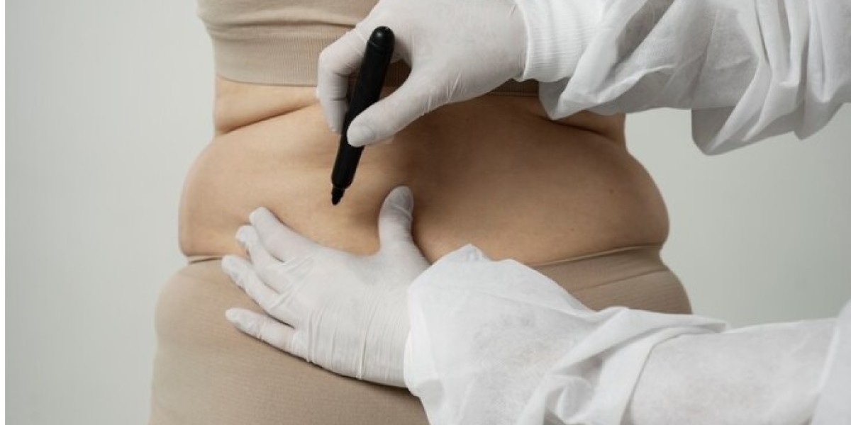 Problems after gastric sleeve surgery