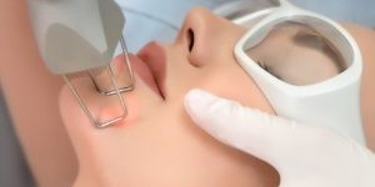 Fractional CO2 Laser: 14 Essential Things You Should Know About This Acne Scar Treatment