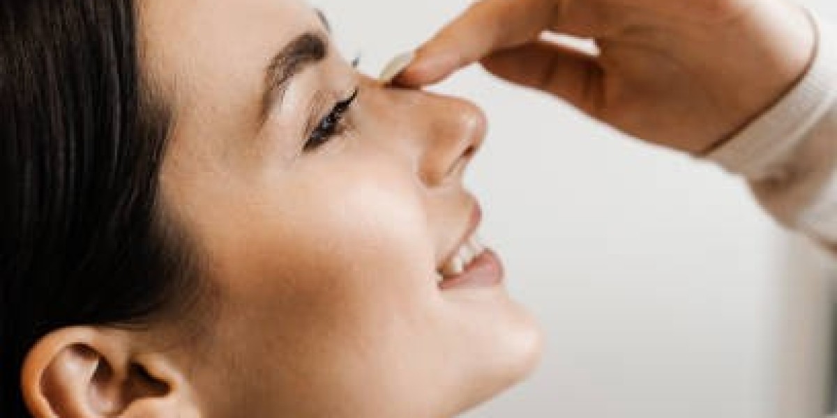 Tips for a Smooth Rhinoplasty Recovery Process in Dubai