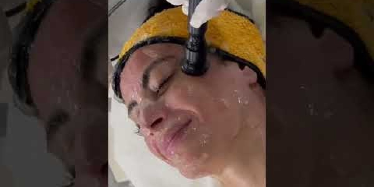 Thread Lift: What to Expect, Benefits & Complications