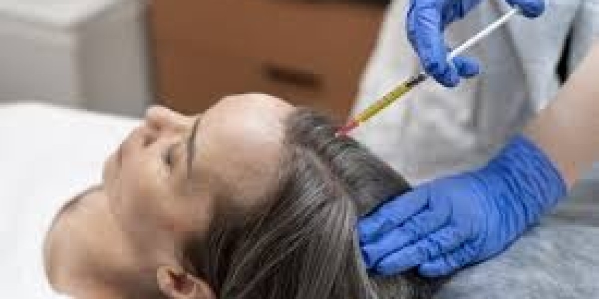دبي مقابل العالم: كيف أصبحت الإمارة مركزًا لزراعة الشعر