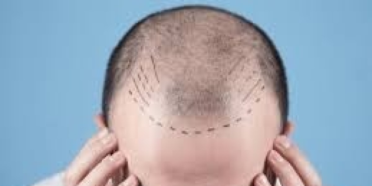 "Unlock Your Hair Potential in Dubai for Just 1 Dirham"