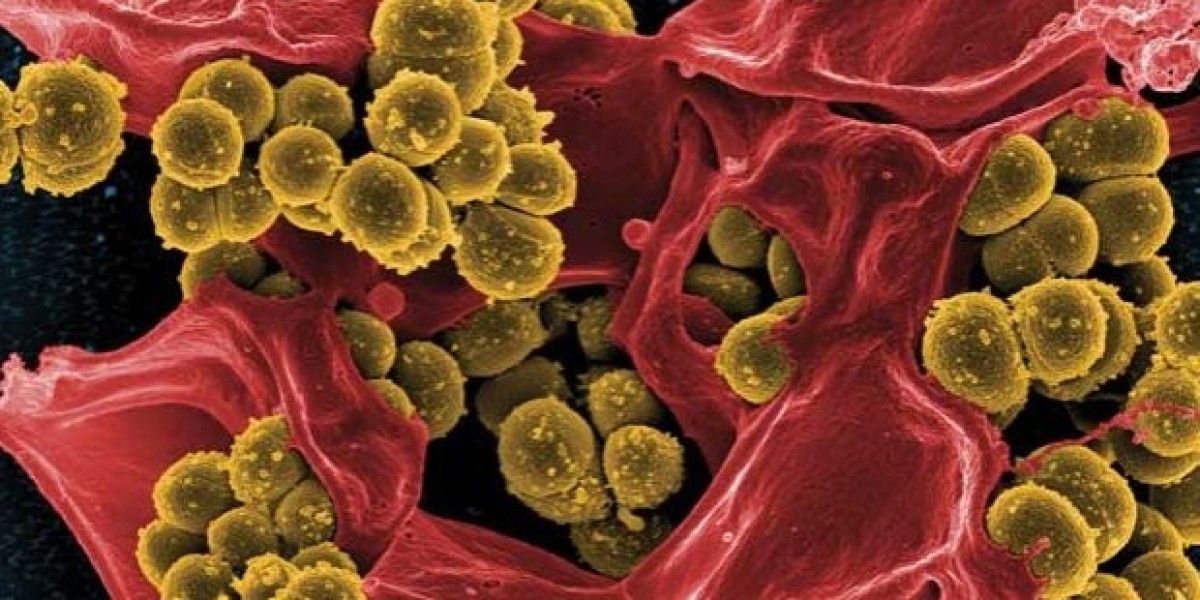 Sepsis Market Research | 2024-2034