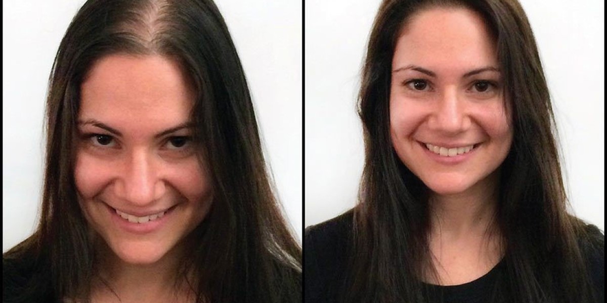Extensions With Thin Hair