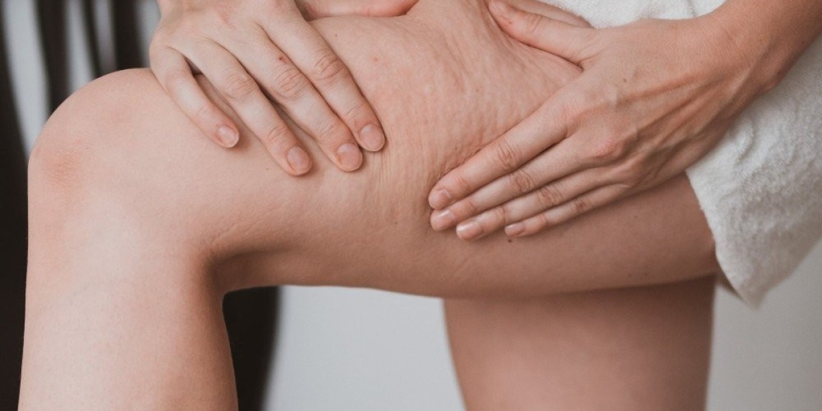 Non-Invasive Treatments for Cellulite Reduction