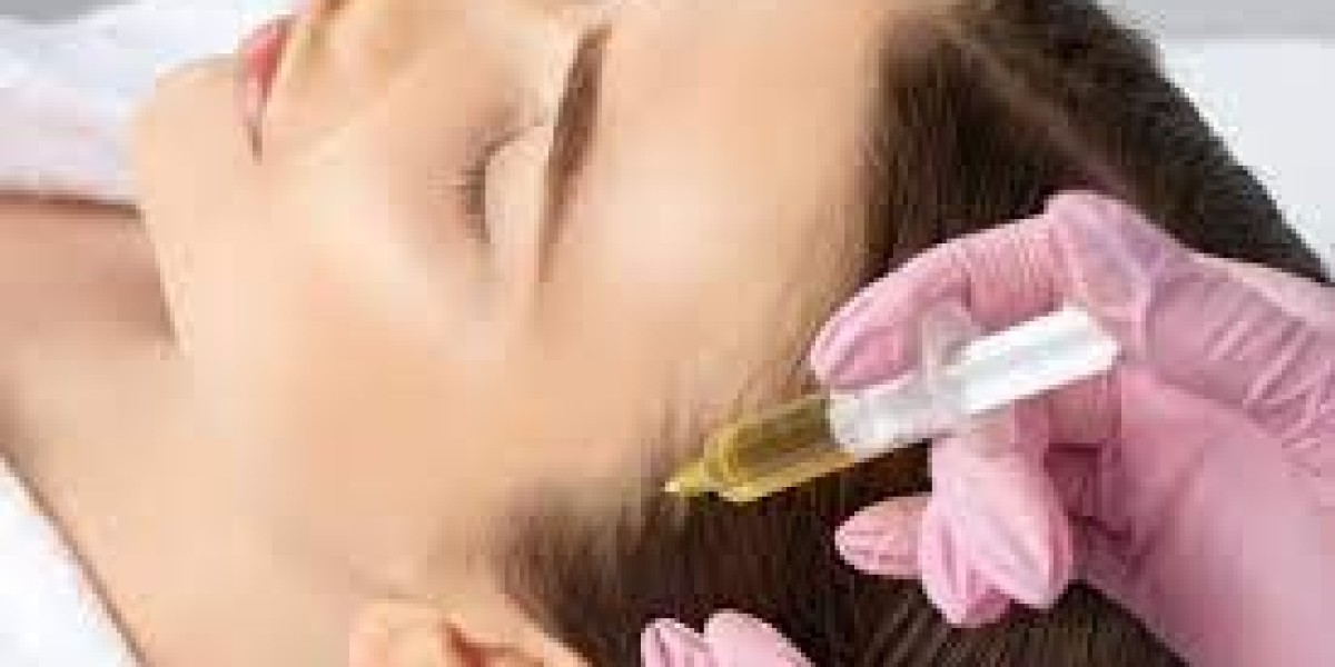 Best PRP Hair Restoration in Dubai: Regrowth with Platelet Power