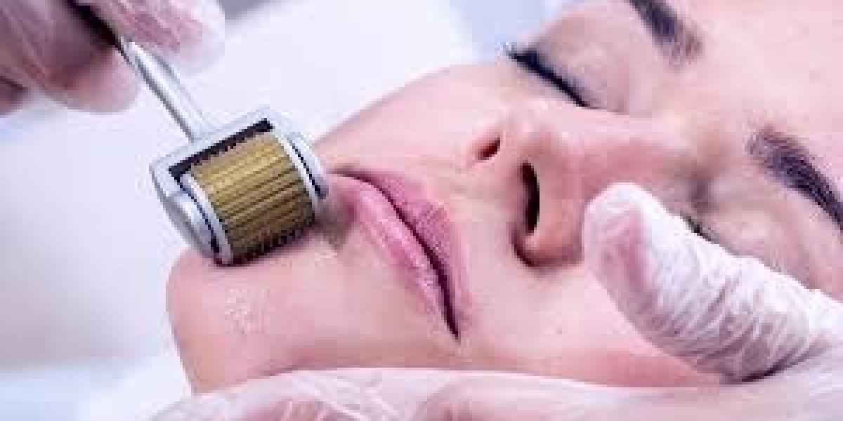 Derma Rollers for Hair
