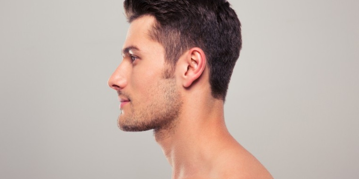 Enhance Your Facial Harmony with Sideburn Hair Transplant