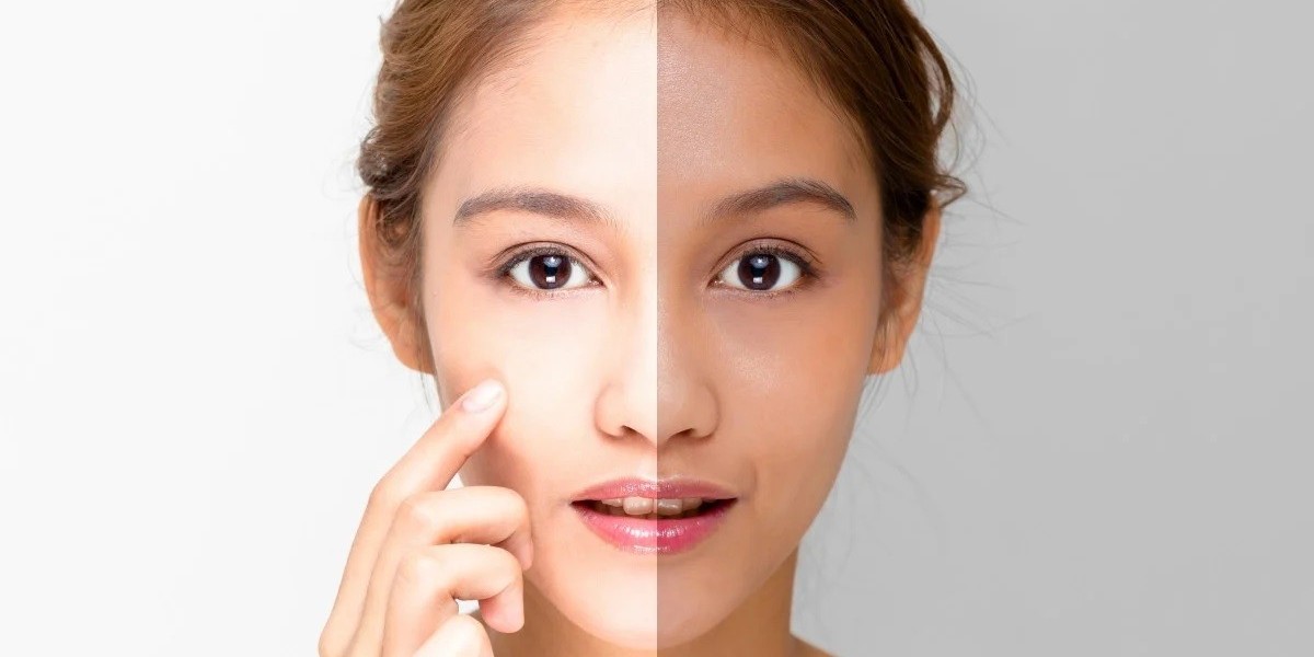Dubai's Secret to Radiant Skin: Top Skin Whitening Treatments Revealed!