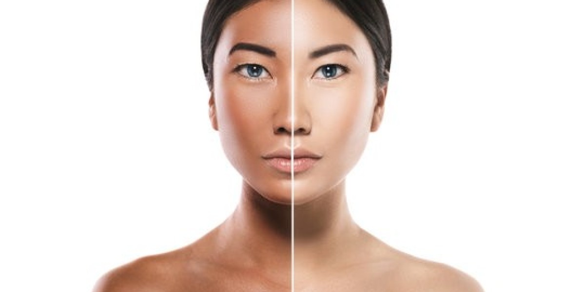 Understanding Skin Whitening Injections: How Do They Work?