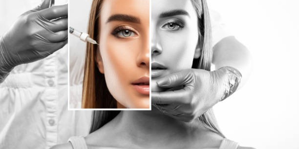 Cheek Filler Essentials: Beauty in Riyadh