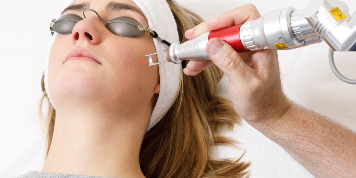 Pico Laser Treatment: Enhancing Skin Health with Precision