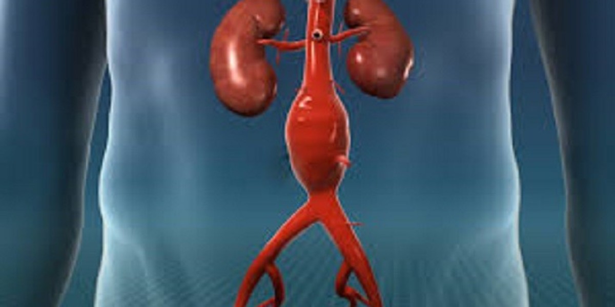 Abdominal Aortic Aneurysm Market: Analysis of Epidemiology, Industry Trends, Size, Share, and Future Forecast (2024-2034