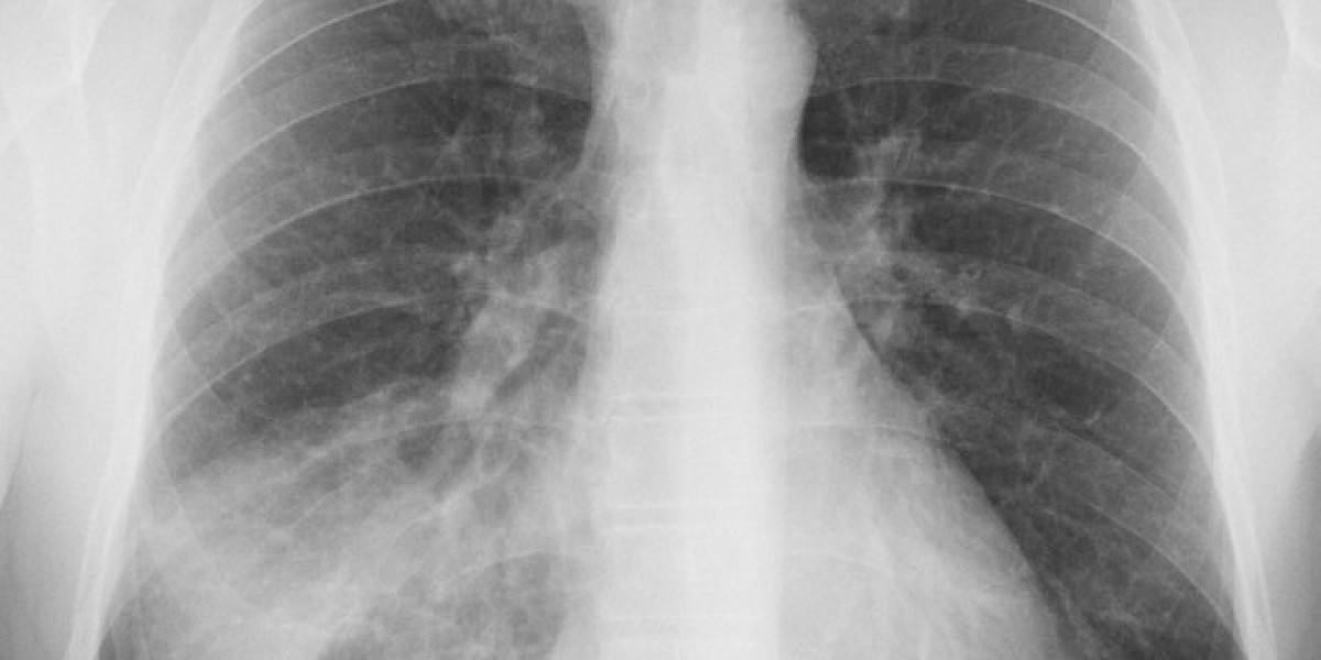 Demystifying PNA: Understanding the Crucial Medical Abbreviation