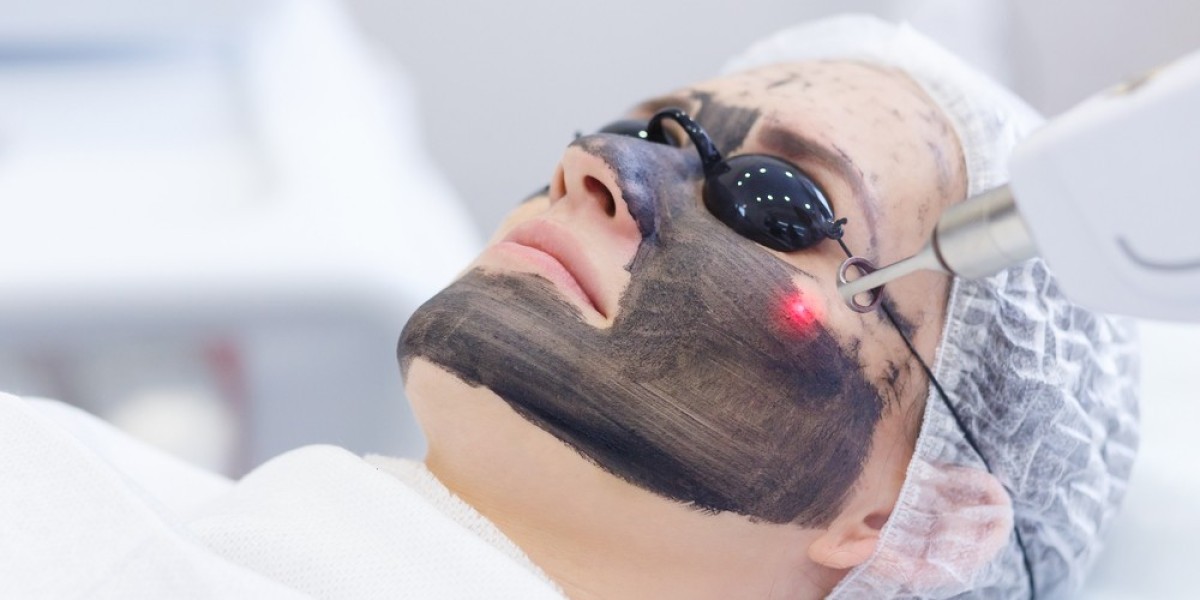 What Results Can I Expect from Laser Carbon Peel?