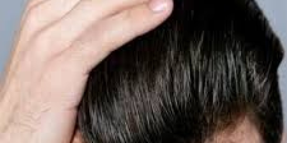 كيف تعمل عملية زراعة الشعر بدرهم واحد في دبي؟