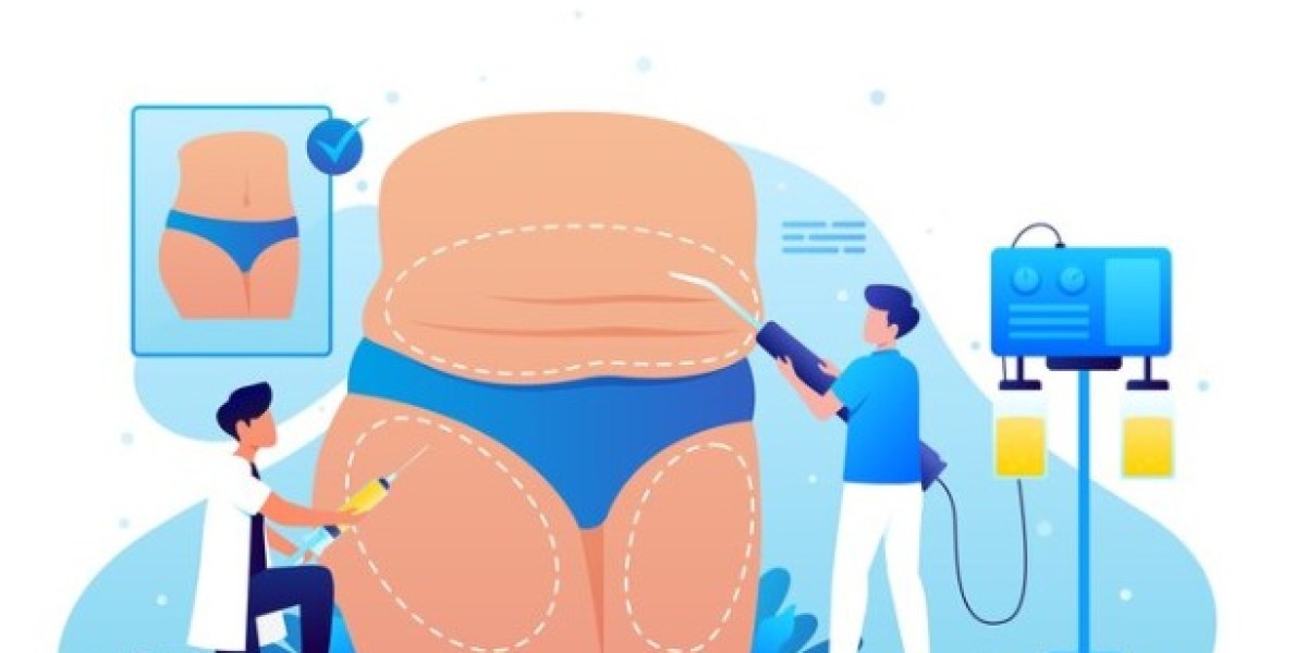 The Best Gallbladder Removal Surgery in Rajinder Nagar, Delhi