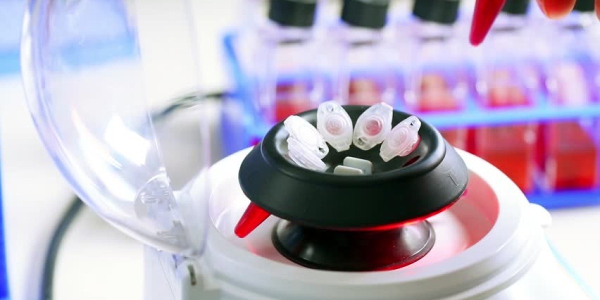 Laboratory Centrifuge Market Trends, Growth Factors, Analysis, and Forecast 2024-2032