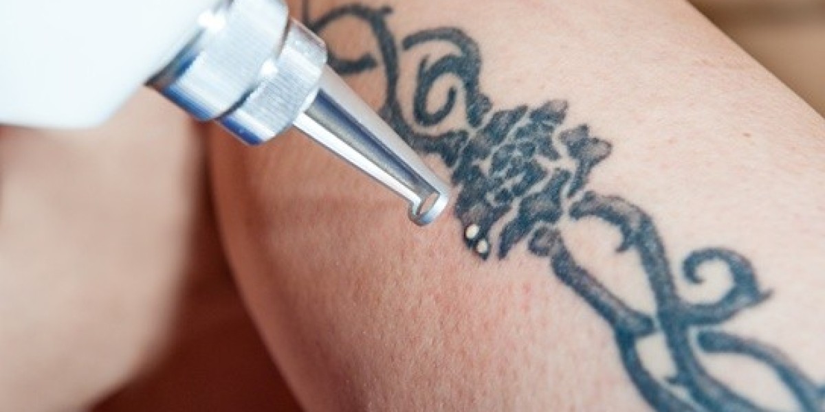 Laser Tattoo Removal Aftercare: Essential Tips for Optimal Results