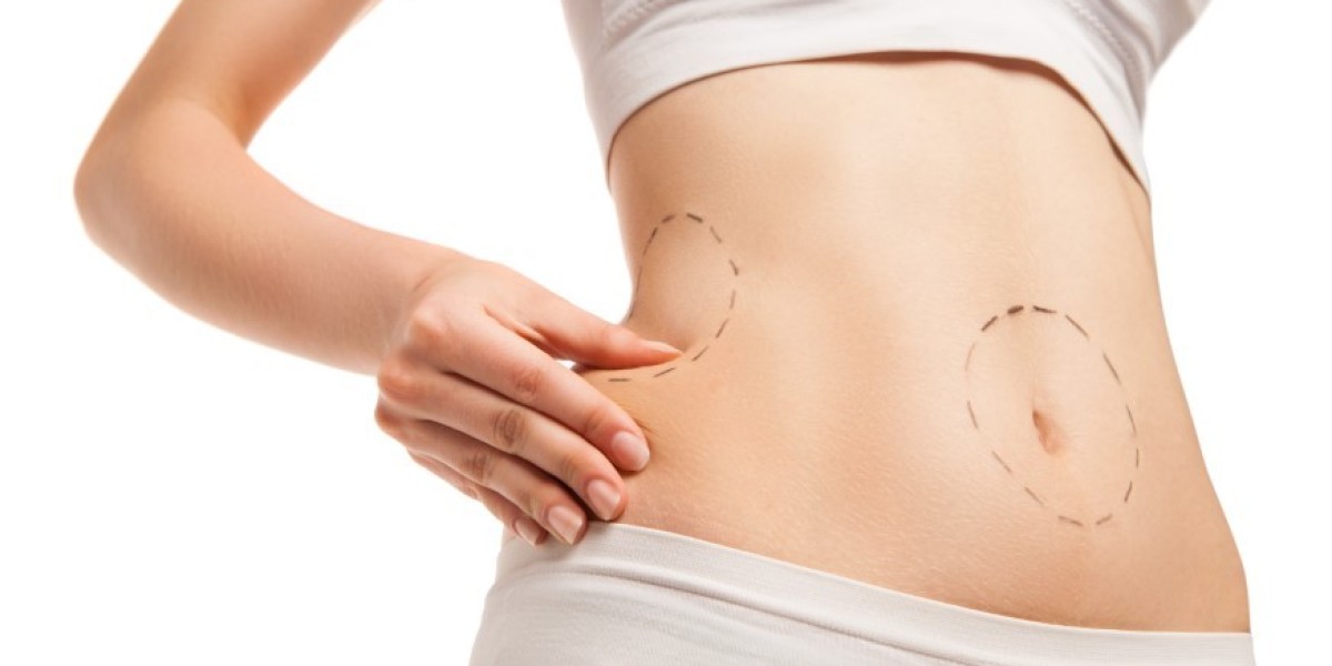 What is the maximum weight for liposuction?