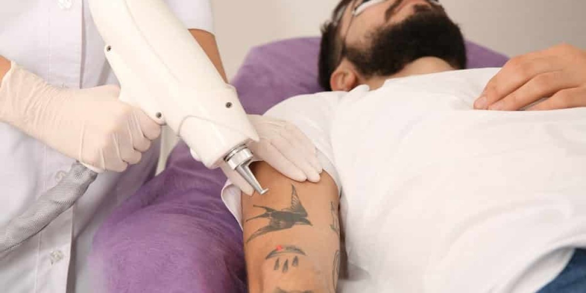 Choosing the Right Laser Tattoo Removal Service in Riyadh