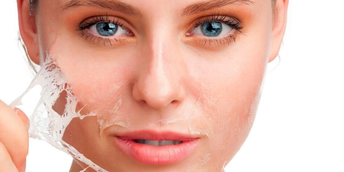Get the Glow: Benefits of Regular Salicylic Acid Peeling