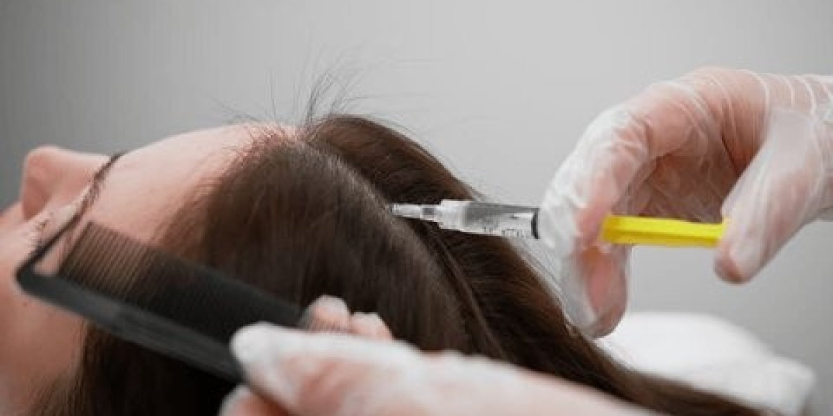 The Best Surgical Hair Loss Treatments: Before and After