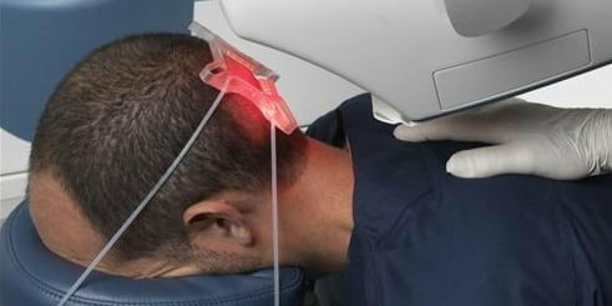 Pros and Cons of Robotic Hair Transplant Cost in Dubai