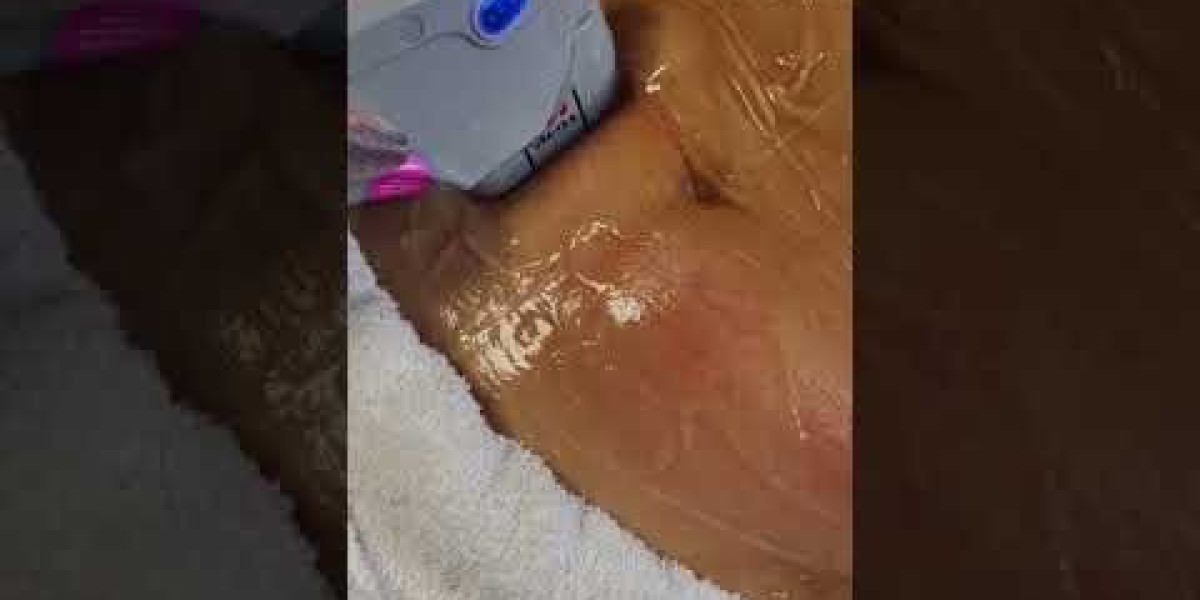 Face Tape Is TikTok's Latest Anti-Aging Trend