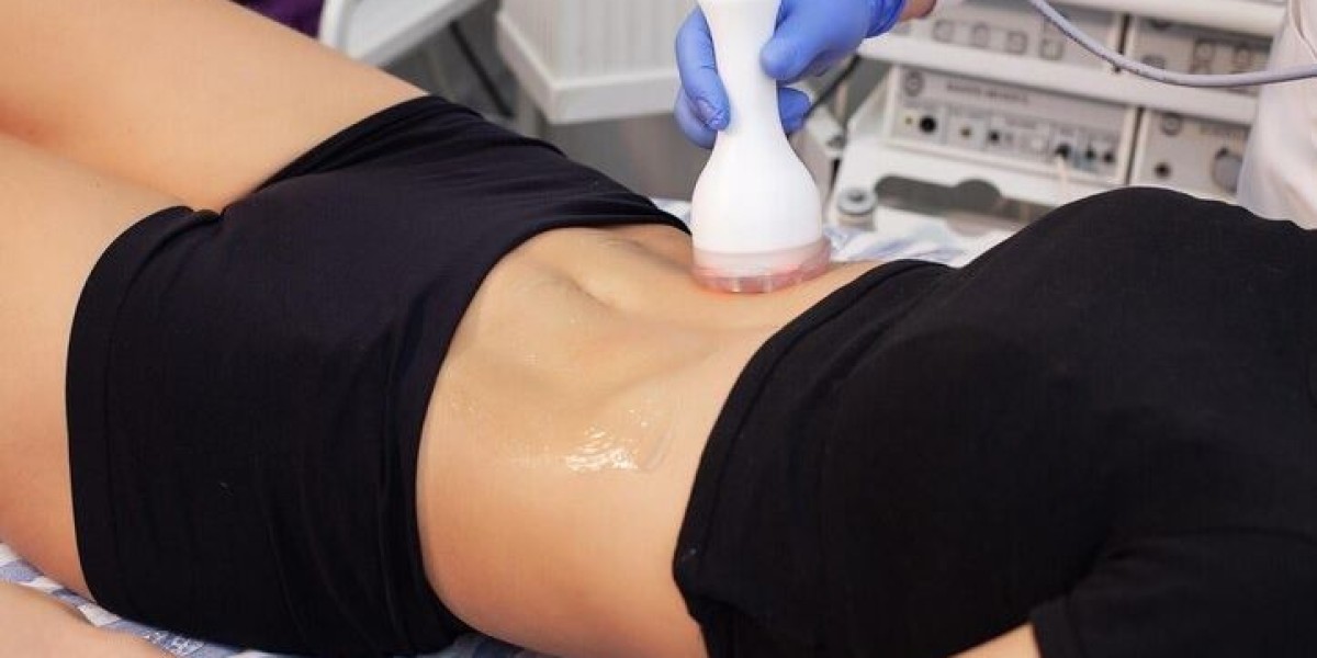 Laser Fat Reduction: Advancing Non-Invasive Body Contouring