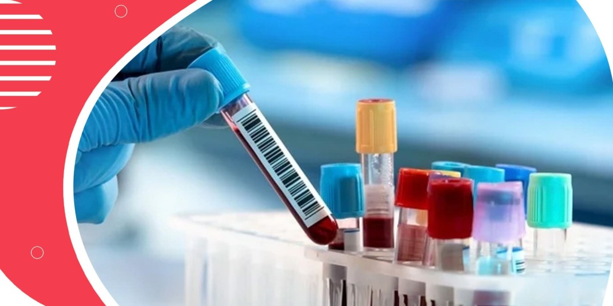 Europe In-Vitro Diagnostics Market Trends Shaping 2024-2032