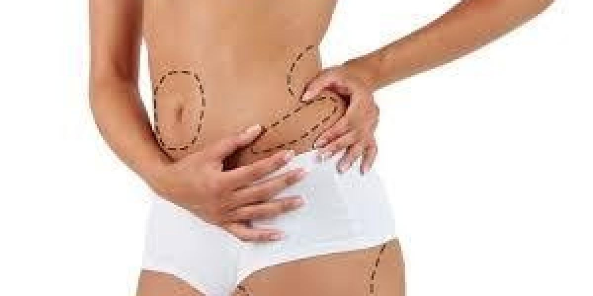 Sculpt Your Dream Body in Paradise With Liposuction In Dubai