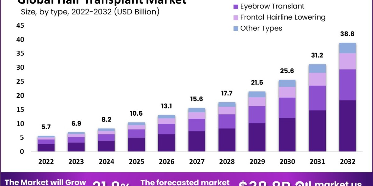Hair Transplant Market Analysis: What’s Driving the Surge in Hair Restoration Procedures?