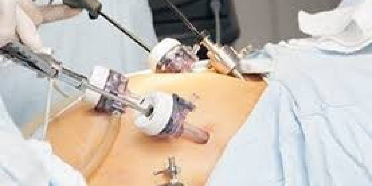 The Science Behind Laparoscopic Surgery: What You Need to Know